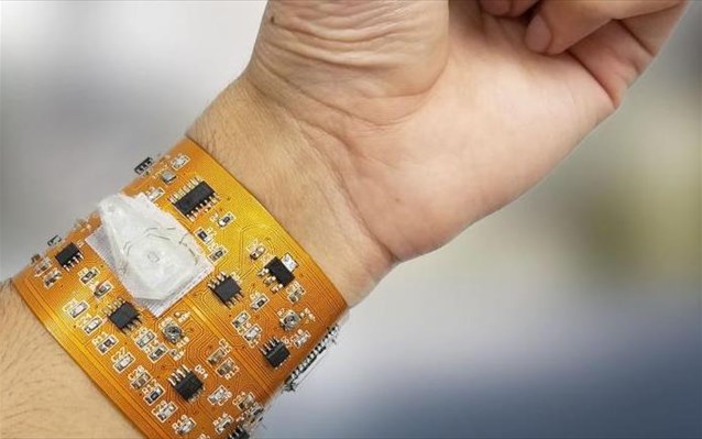 «Έξυπνο» περιβραχιόνιο υπόσχεται επανάσταση στις συσκευές παρακολούθησης υγείας του χρήστη